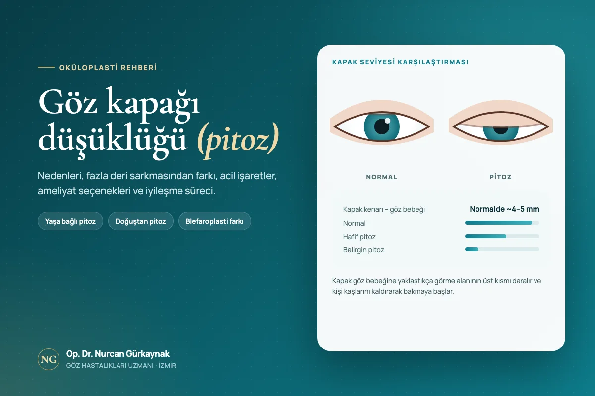 Göz Kapağı Düşüklüğü (Pitoz): Nedenleri, Ameliyatı ve İyileşme Süreci
